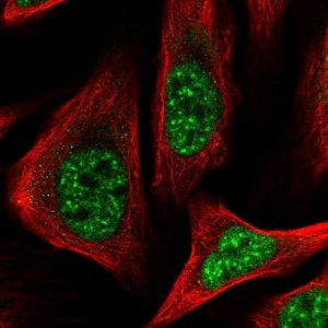 Anti-ZC2HC1C antibody produced in rabbit 