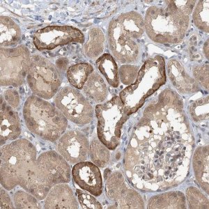 Anti-ZC3H12A antibody produced in rabbit 