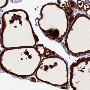 Anti-ZC3H12C antibody produced in rabbit 