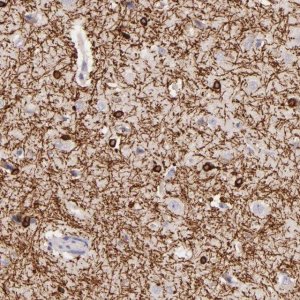 Anti-ZC3H7B antibody produced in rabbit 