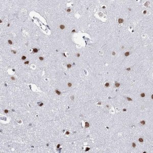 Anti-ZC3H8 antibody produced in rabbit 