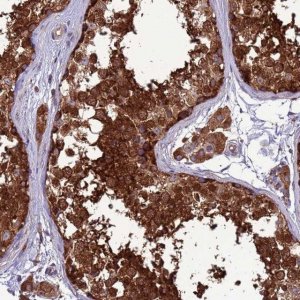 Anti-ZC3HAV1 antibody produced in rabbit 