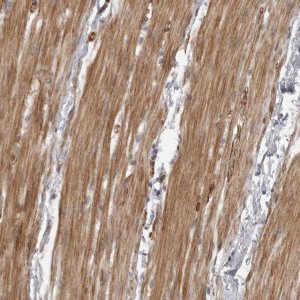 Anti-ZCCHC11 antibody produced in rabbit 