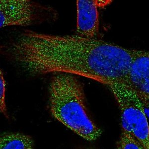 Anti-ZCCHC11 antibody produced in rabbit 