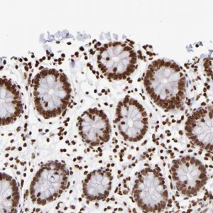 Anti-ZCCHC16 antibody produced in rabbit 