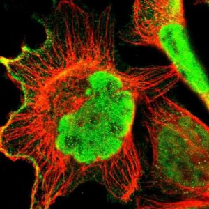Anti-ZCCHC16 antibody produced in rabbit 