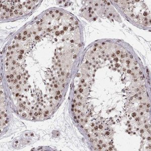 Anti-ZCCHC17 antibody produced in rabbit 
