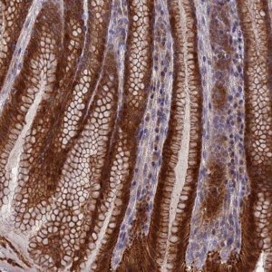 Anti-ZCCHC2 antibody produced in rabbit 