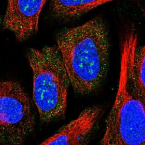Anti-ZCCHC2 antibody produced in rabbit 