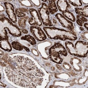 Anti-ZCCHC24 antibody produced in rabbit 