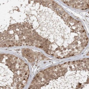 Anti-ZCCHC4 antibody produced in rabbit 