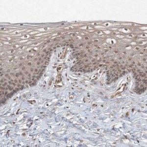 Anti-ZCCHC4 antibody produced in rabbit 