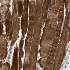 Anti-ZCCHC6 antibody produced in rabbit 