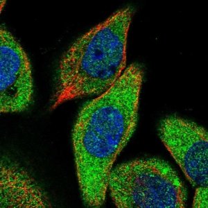Anti-ZCCHC6 antibody produced in rabbit 