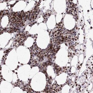 Anti-ZCCHC8 antibody produced in rabbit 