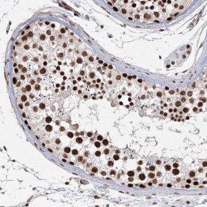 Anti-ZCCHC8 antibody produced in rabbit 