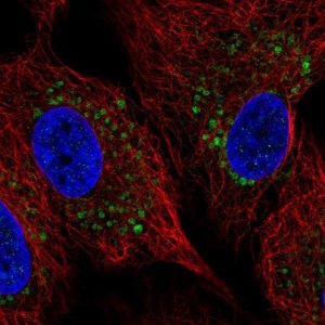 Anti-ZDHHC11B antibody produced in rabbit 