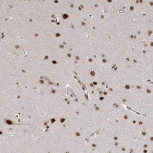Anti-ZDHHC12 antibody produced in rabbit 