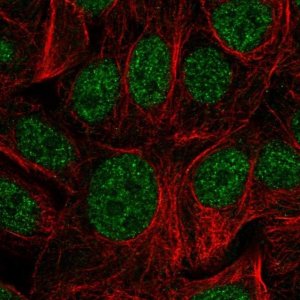 Anti-ZDHHC12 antibody produced in rabbit 