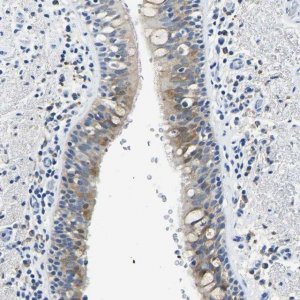 Anti-ZDHHC13 antibody produced in rabbit 