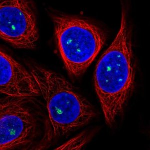 Anti-ZDHHC14 antibody produced in rabbit 
