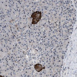 Anti-ZDHHC15 antibody produced in rabbit 
