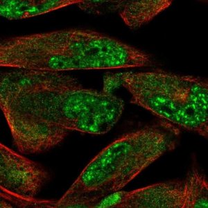 Anti-ZDHHC15 antibody produced in rabbit 