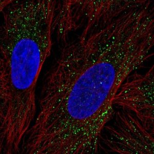 Anti-ZDHHC17 antibody produced in rabbit 