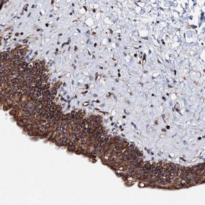 Anti-ZDHHC18 antibody produced in rabbit 