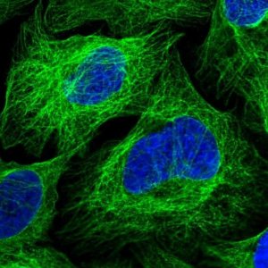 Anti-ZDHHC18 antibody produced in rabbit 