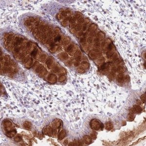 Anti-ZDHHC2 antibody produced in rabbit 