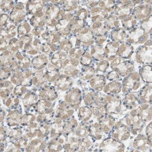 Anti-ZDHHC20 antibody produced in rabbit 