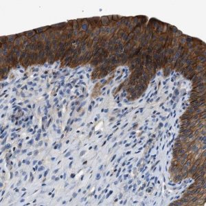 Anti-ZDHHC24 antibody produced in rabbit 