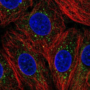 Anti-ZDHHC24 antibody produced in rabbit 