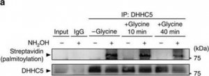 Anti-ZDHHC5 antibody produced in rabbit 
