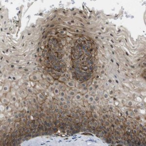 Anti-ZDHHC5 antibody produced in rabbit 