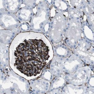 Anti-ZDHHC6 antibody produced in rabbit 