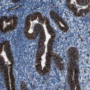 Anti-ZDHHC6 antibody produced in rabbit 