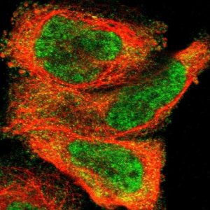 Anti-ZDHHC8 antibody produced in rabbit 