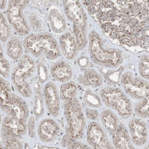Anti-ZFAND2B antibody produced in rabbit HPA035159-100UL