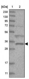 Anti-ZFAND2B antibody produced in rabbit HPA035159-100UL