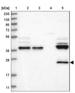 Anti-ZFAND6 antibody produced in rabbit 