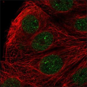 Anti-ZFAT antibody produced in rabbit 