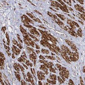 Anti-ZFP36L2 antibody produced in rabbit 
