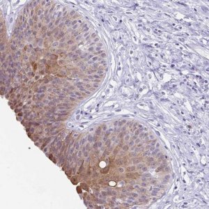 Anti-ZFP64 antibody produced in rabbit 