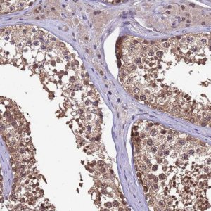 Anti-ZFP69B antibody produced in rabbit 