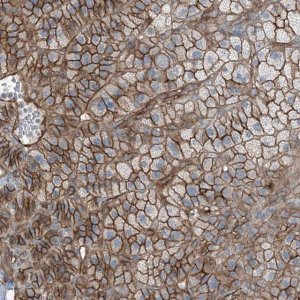 Anti-ZFP90 antibody produced in rabbit 