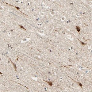 Anti-ZFPM2 antibody produced in rabbit 