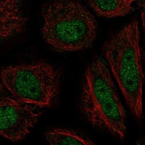 Anti-ZFY antibody produced in rabbit 
