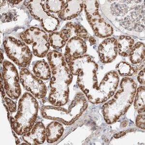 Anti-ZFYVE16 antibody produced in rabbit 